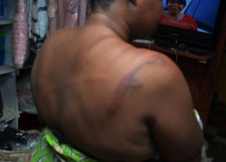 The travails, agony of Lady assaulted by Police Officers amidst Coronavirus lockdown
