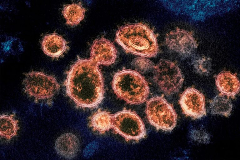 COVID-19 can affect male fertility, research shows