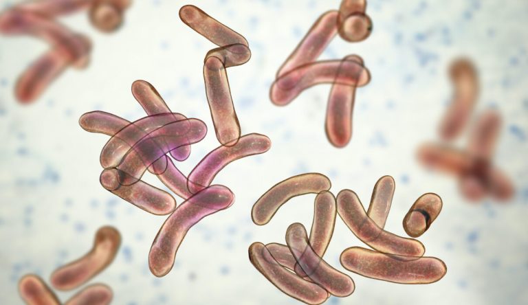 20 people have been killed by Cholera in Bauchi