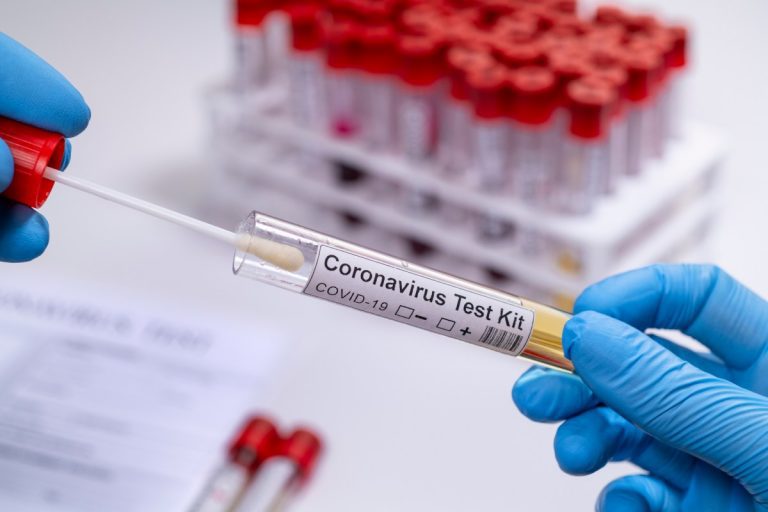 Canada’s claim that Africa’s COVID test results are inaccurate – NICD disagrees
