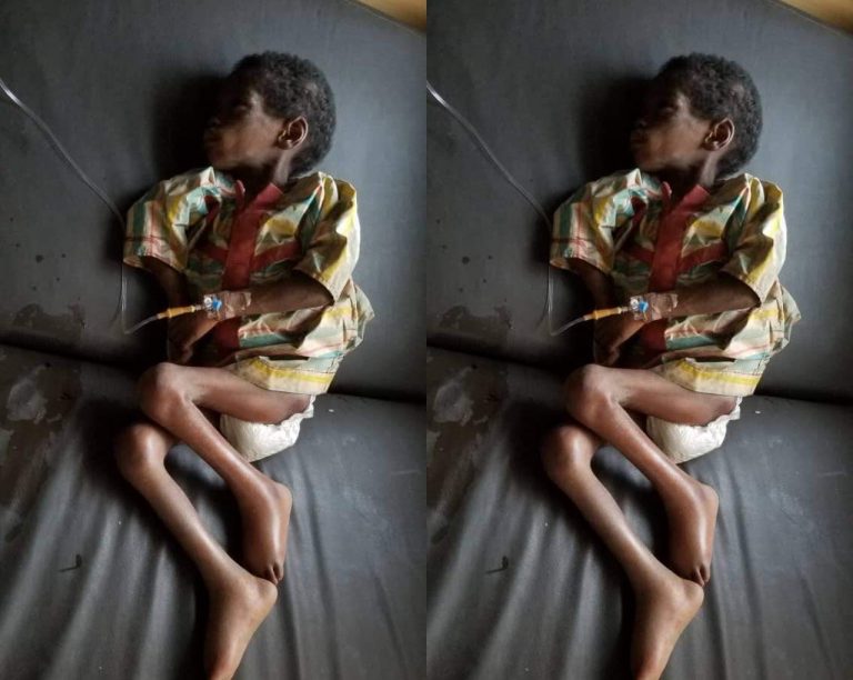 Govt of Osun rescues abandoned, malnourished 7-year-old girl