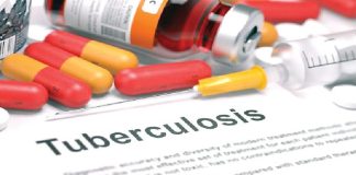 Enugu, Borno record 7,496 tuberculosis case, 1,869 killed in Kwara