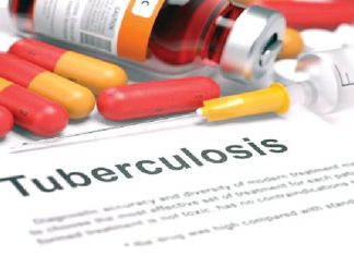 Enugu, Borno record 7,496 tuberculosis case, 1,869 killed in Kwara