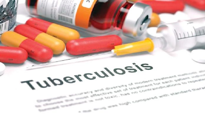 Enugu, Borno record 7,496 tuberculosis case, 1,869 killed in Kwara