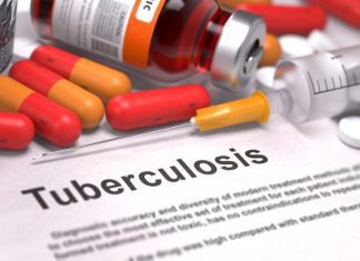 Benue tops North Central in tuberculosis cases -Commissioner