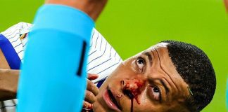 Euro 2024: Mbappe suffers broken nose