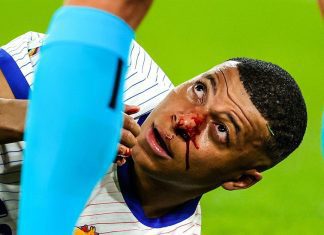 Euro 2024: Mbappe suffers broken nose