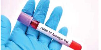 Covid still kills 1,700 weekly- WHO