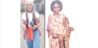 How I became an amputee two days after my birthday – Businesswoman