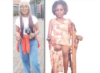 How I became an amputee two days after my birthday – Businesswoman