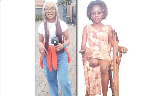 How I became an amputee two days after my birthday – Businesswoman