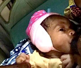 Nursing mothers lament high cost of nourishing foods