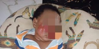 Father seek justice after baby suffers injuries at Lagos school