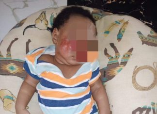 Father seek justice after baby suffers injuries at Lagos school