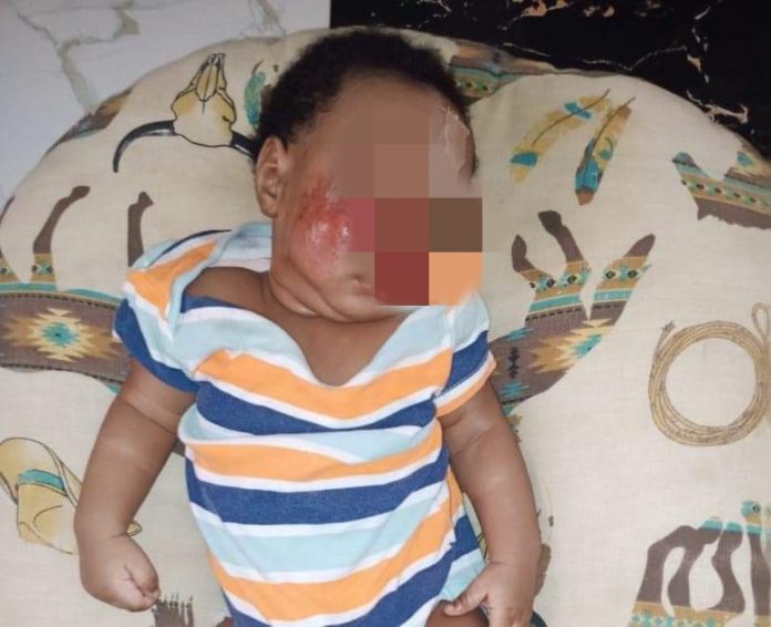 Father seek justice after baby suffers injuries at Lagos school